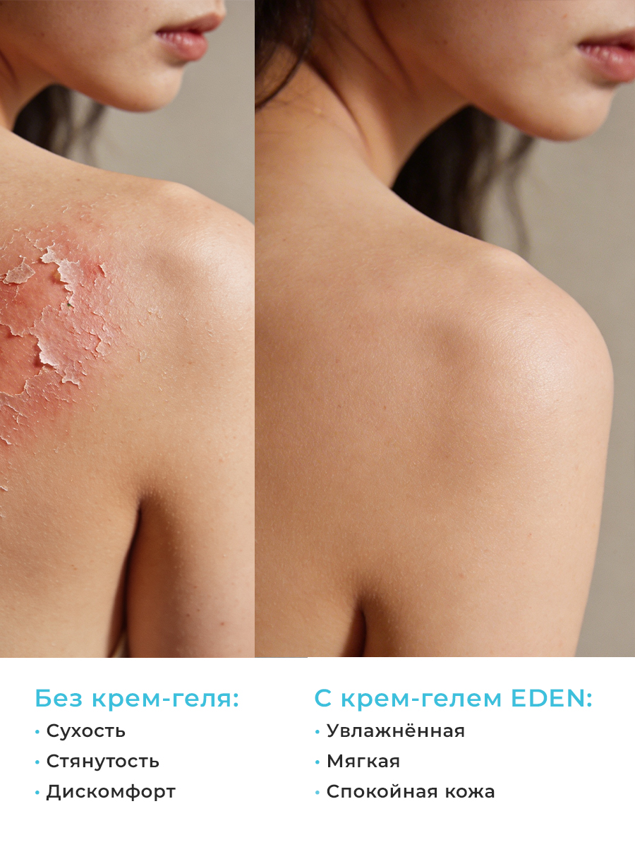 Крем-гель после загара EDEN Sun Series 150мл - фото 7