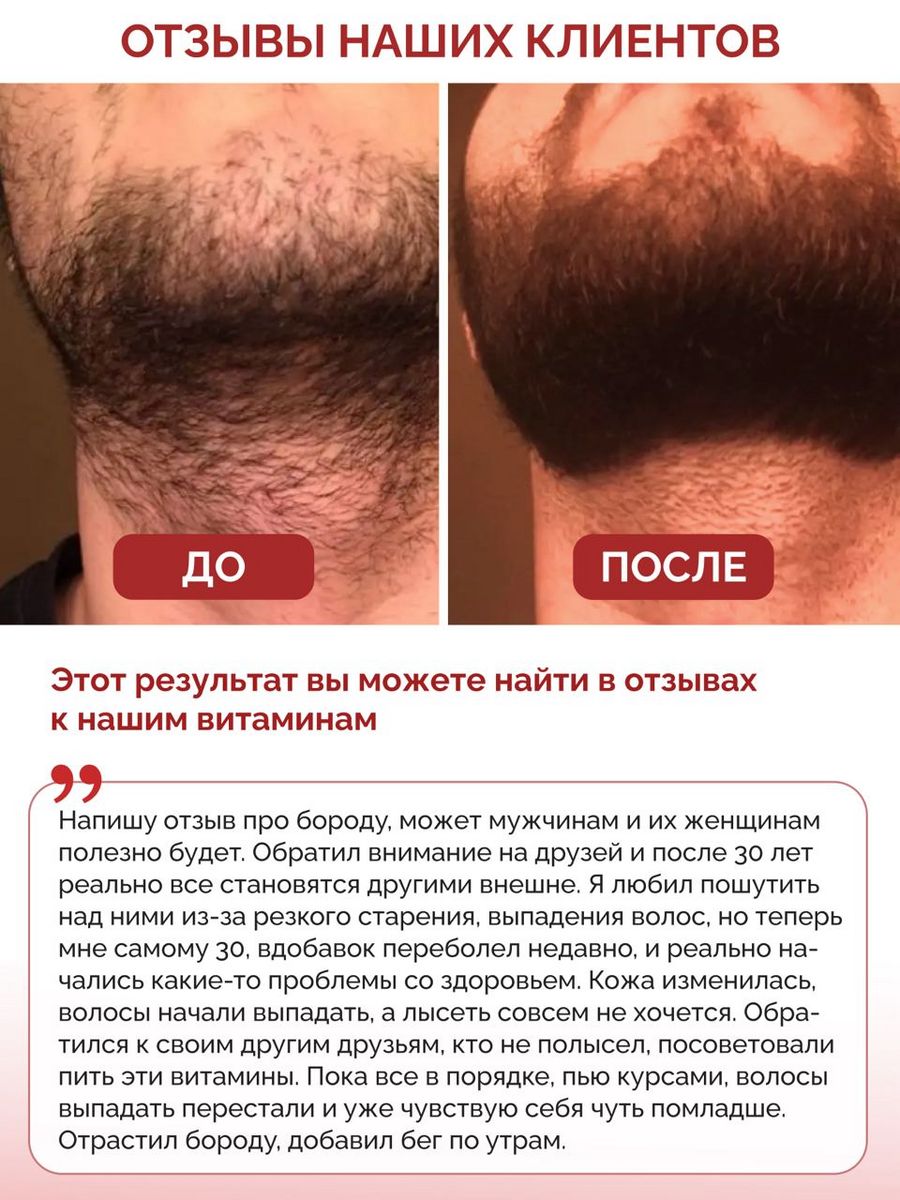 Коллаген витамин С в капсулах BIOTTE с Биоперином для волос ногтей кожи суставов 120 капсул - фото 3