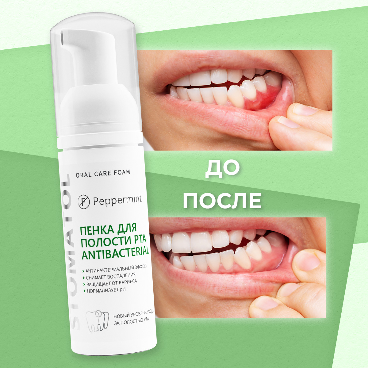 Ополаскиватель STOMATOL Antibacterial 50 мл - фото 6
