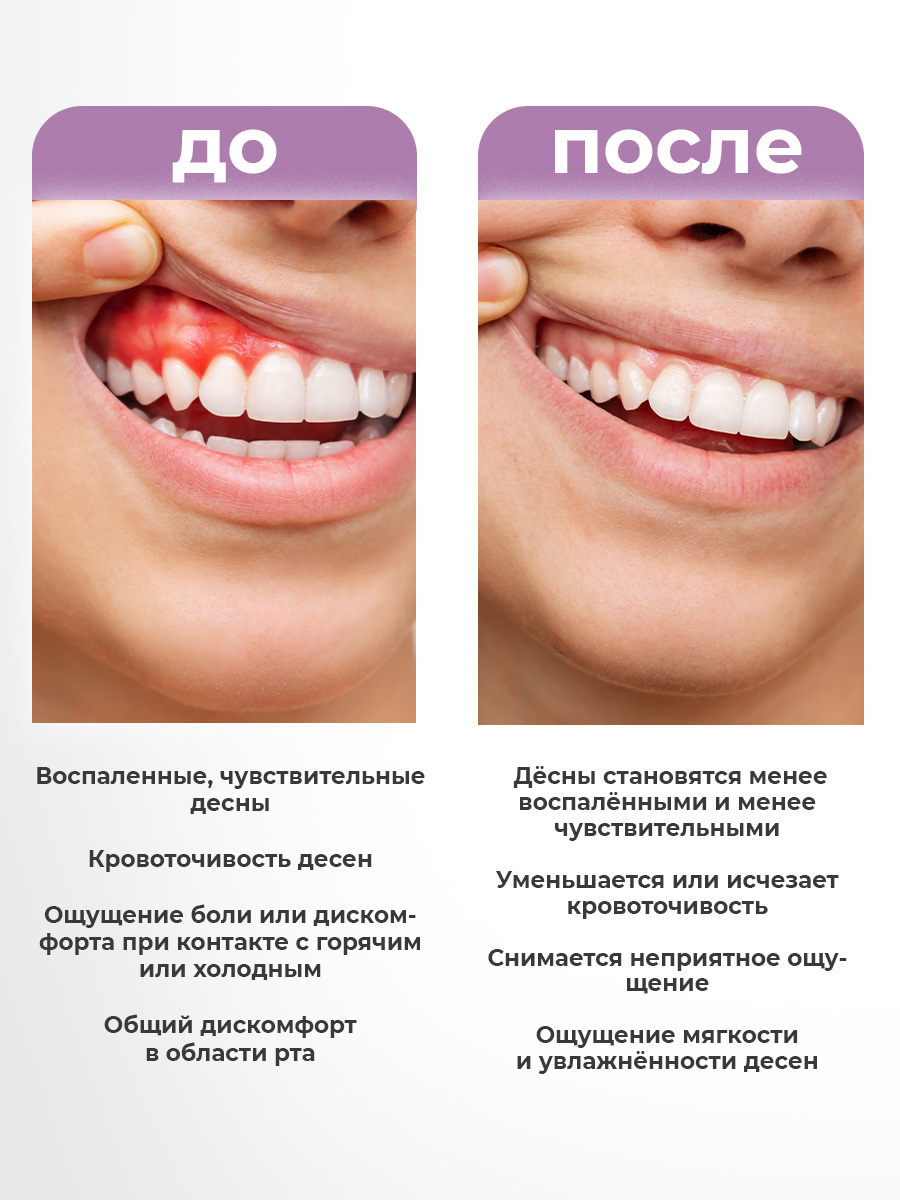 Зубной гель STOMATOL - фото 6