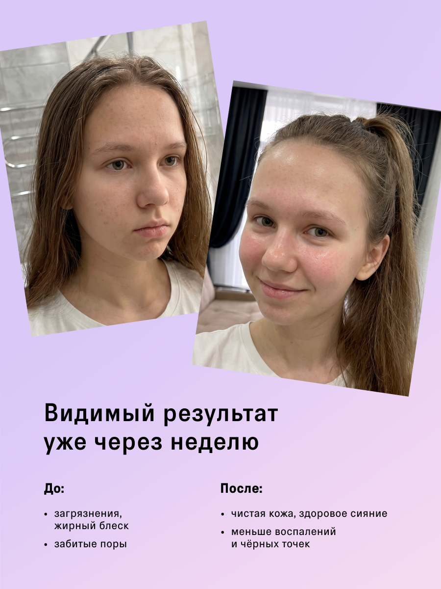 Тоник The Act для лица 200 мл - фото 3