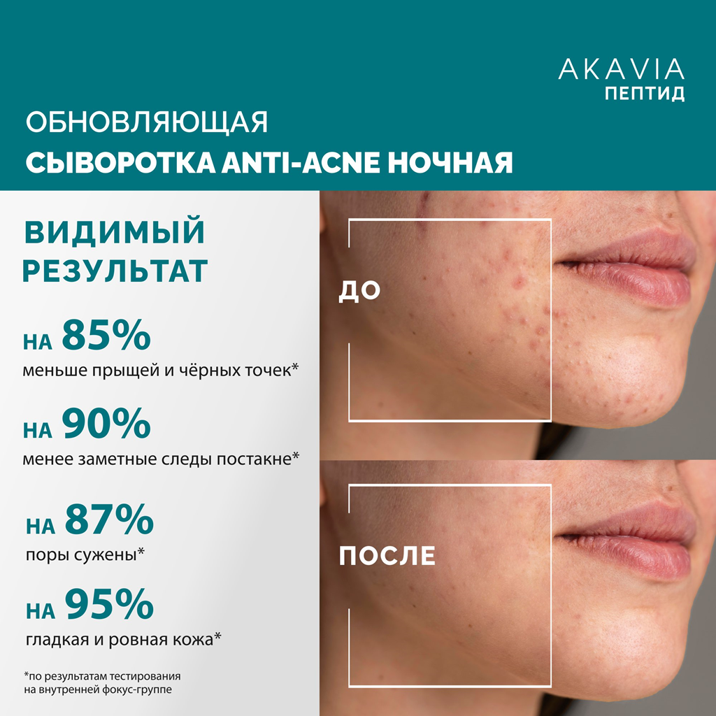 Сыворотка АКАВИЯ Anti-Аcne ночная с кислотами - фото 7