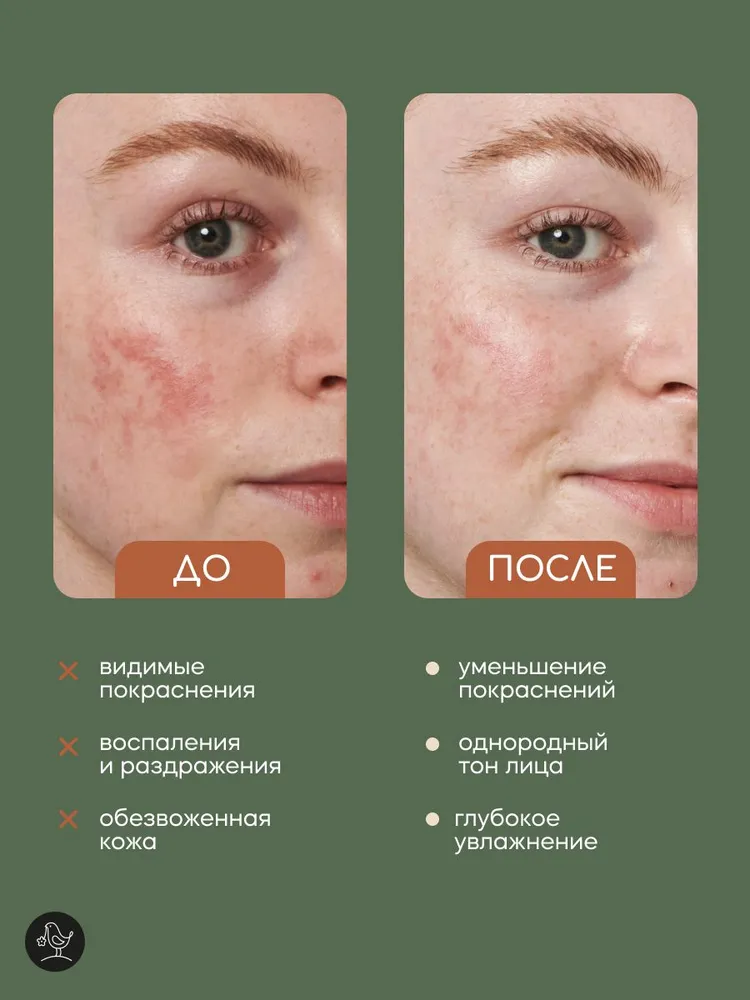 Гидролат Краснополянская косметика 100 мл 2 шт. - фото 3