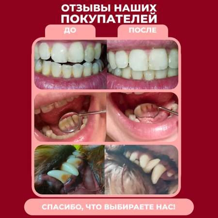 Ирригатор PARU импульсный 3 реж.