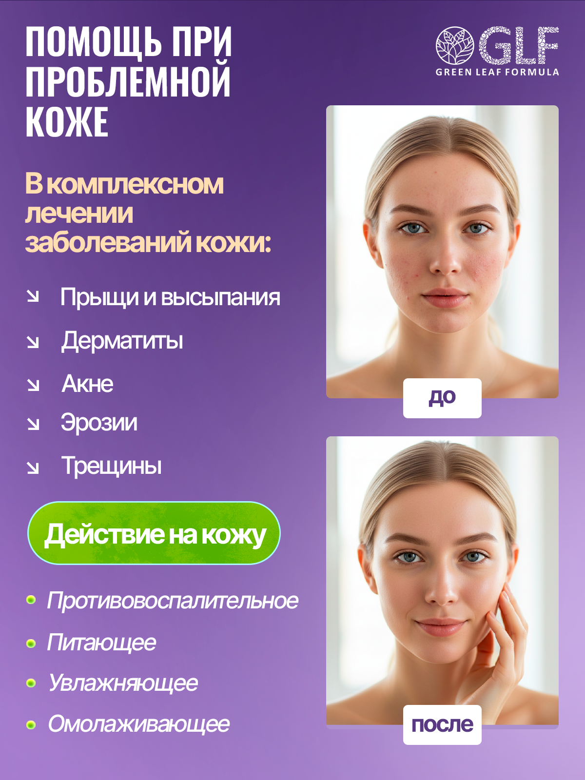 Комплекс витаминов для женщин Green Leaf Formula биотин витамины для кожи волос ногтей 790 мг 30 капсул - фото 4