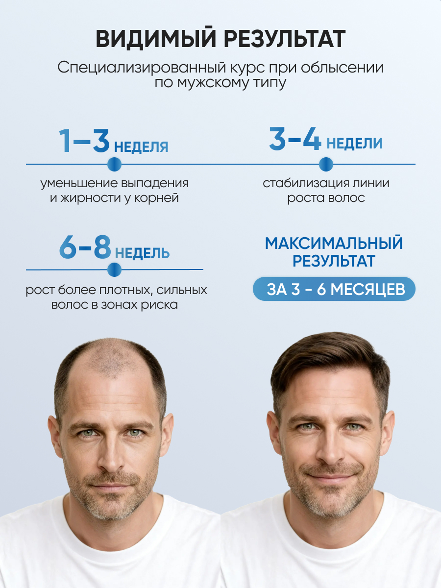 Сыворотка Ринфолтил Для предотвращения облысения - фото 4