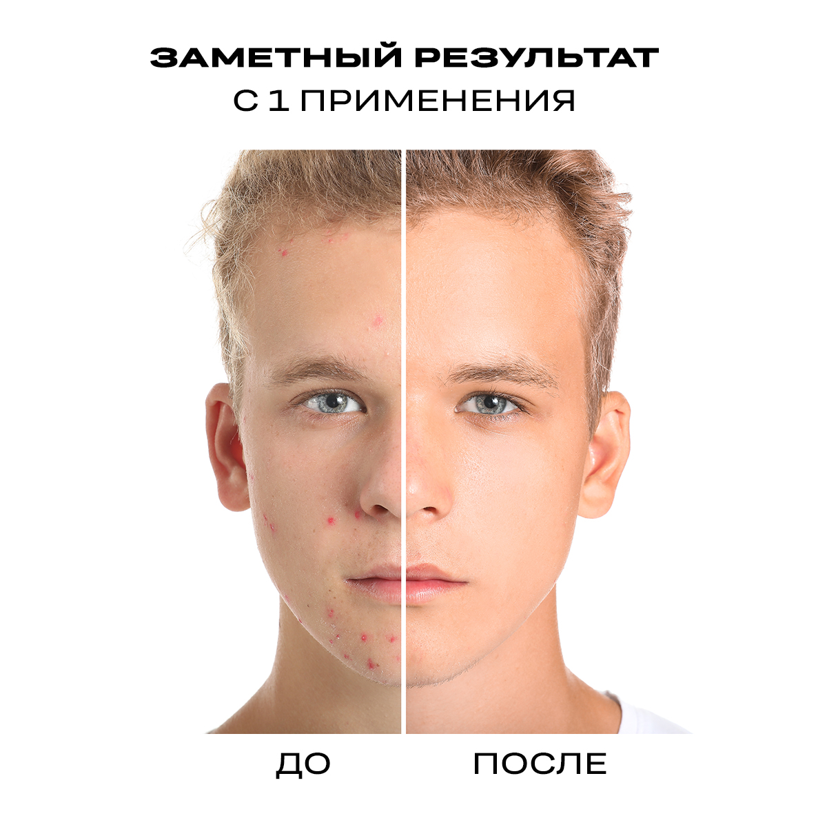 Патчи Funny Organix Чайное дерево - фото 7