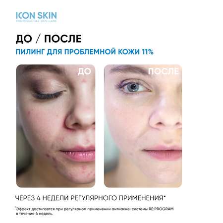 Пилинг ICON SKIN 30 мл