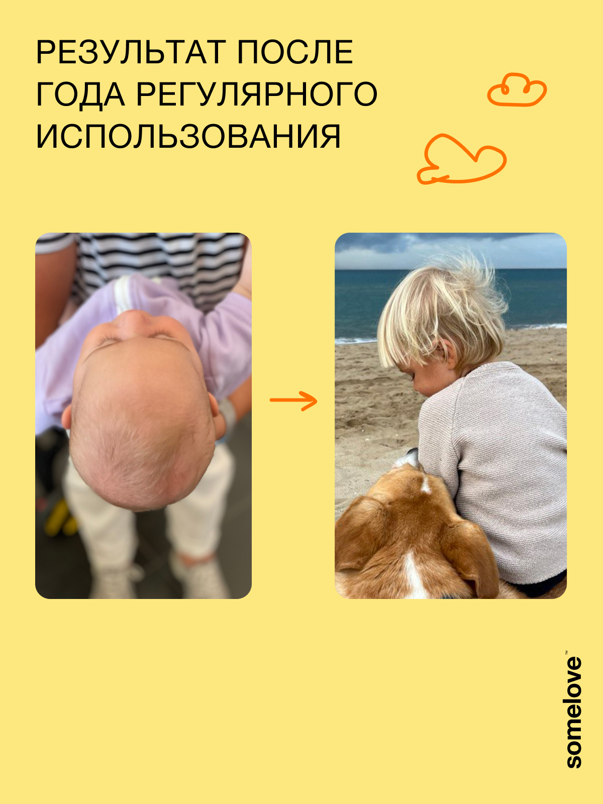 Концентрат somelove «быстрее, гуще, сильнее» 100 мл 1 шт. - фото 6