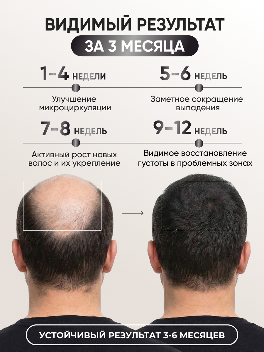 Лосьон Ринфолтил - фото 3